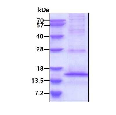 SDS-PAGE: Recombinant Human HIF-1 alpha His Protein [NBP1-49165]